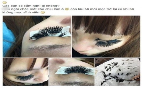 Đi nối mi giá rẻ, người phụ nữ rụng mất hàng mi cong chỉ sau một đêm